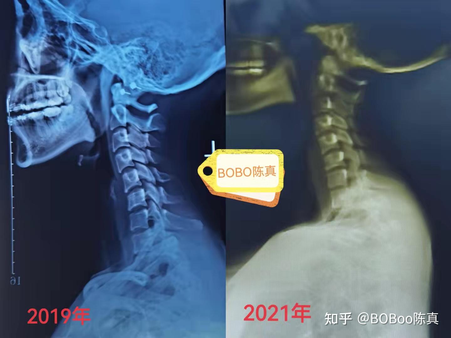 富贵包不可怕,教你消灭它!