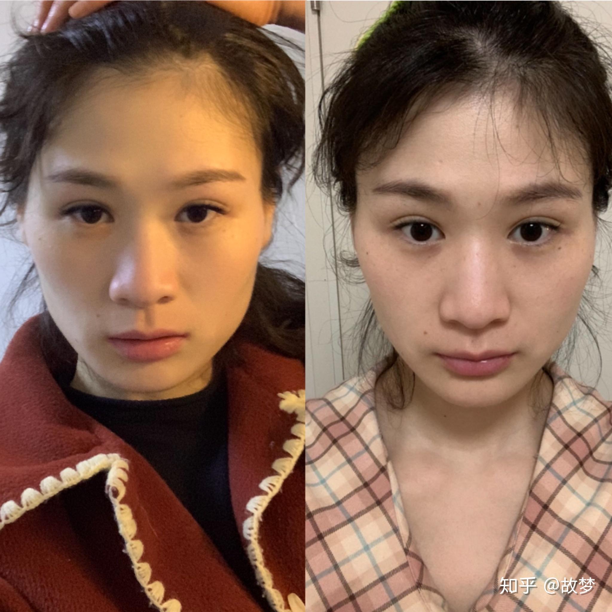 有大小脸,怎么办? - 知乎