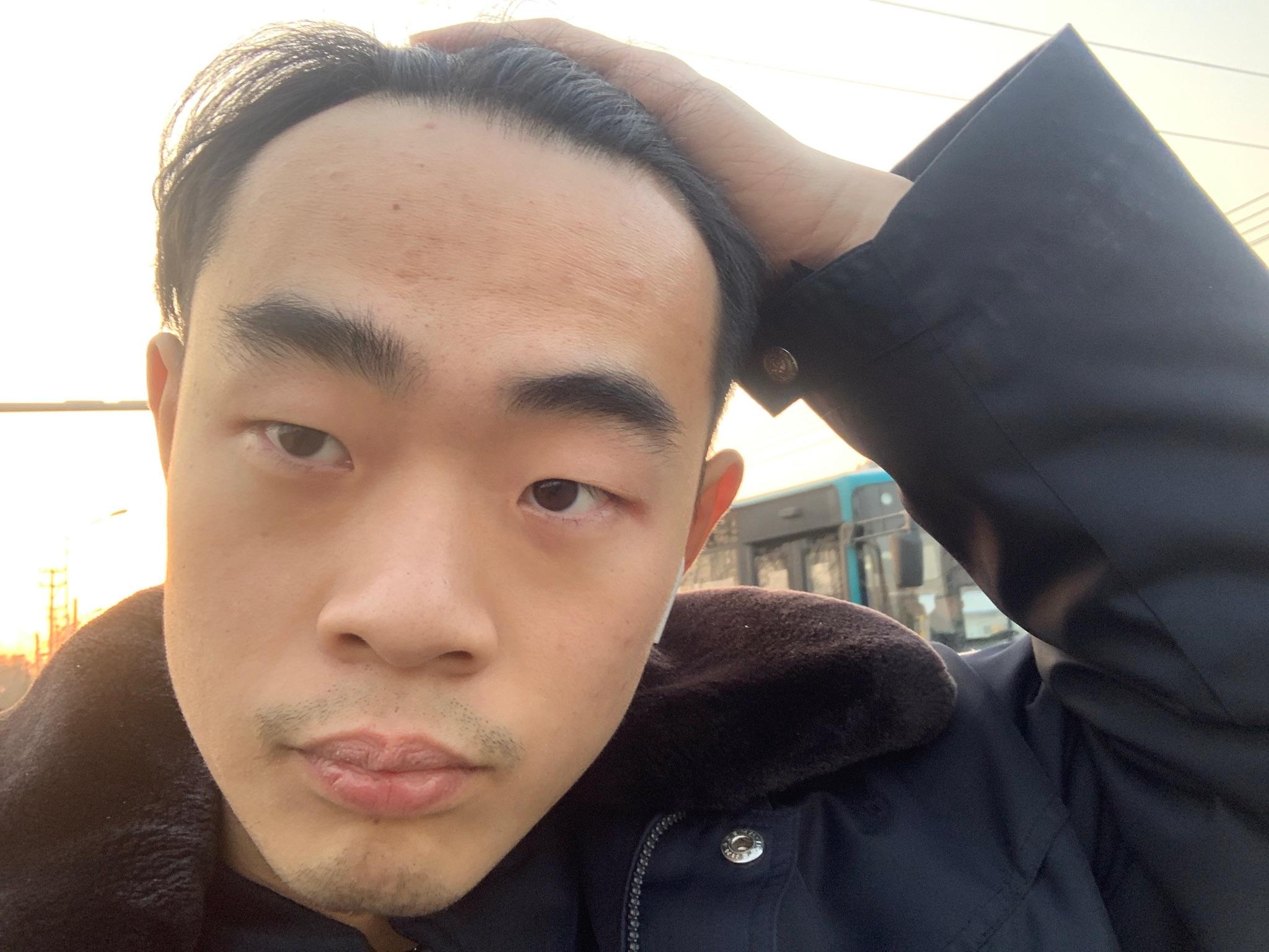 发际线很高的男人适合什么样的发型? - 知乎