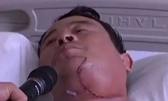 嚼槟榔和抽烟哪个危害更大