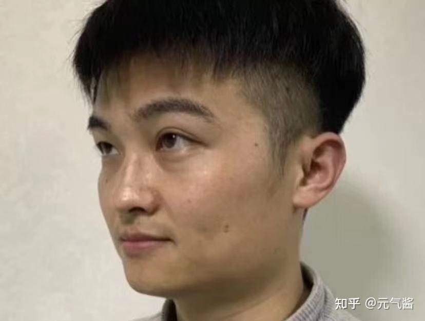 男生切下颚骨觉得可以吗我下颌骨宽大想做手术切掉又怕风险又不知道去