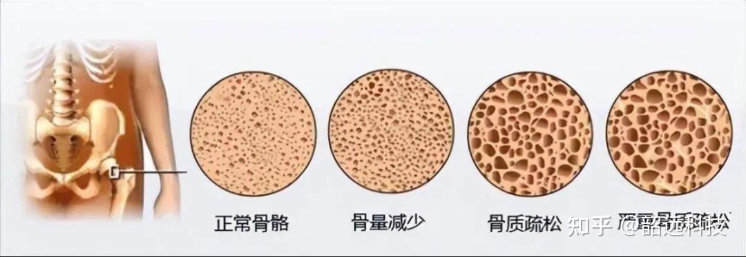 奇妙的化学元素 | 从骨骼奥秘到原子钟革命--锶 - 知乎