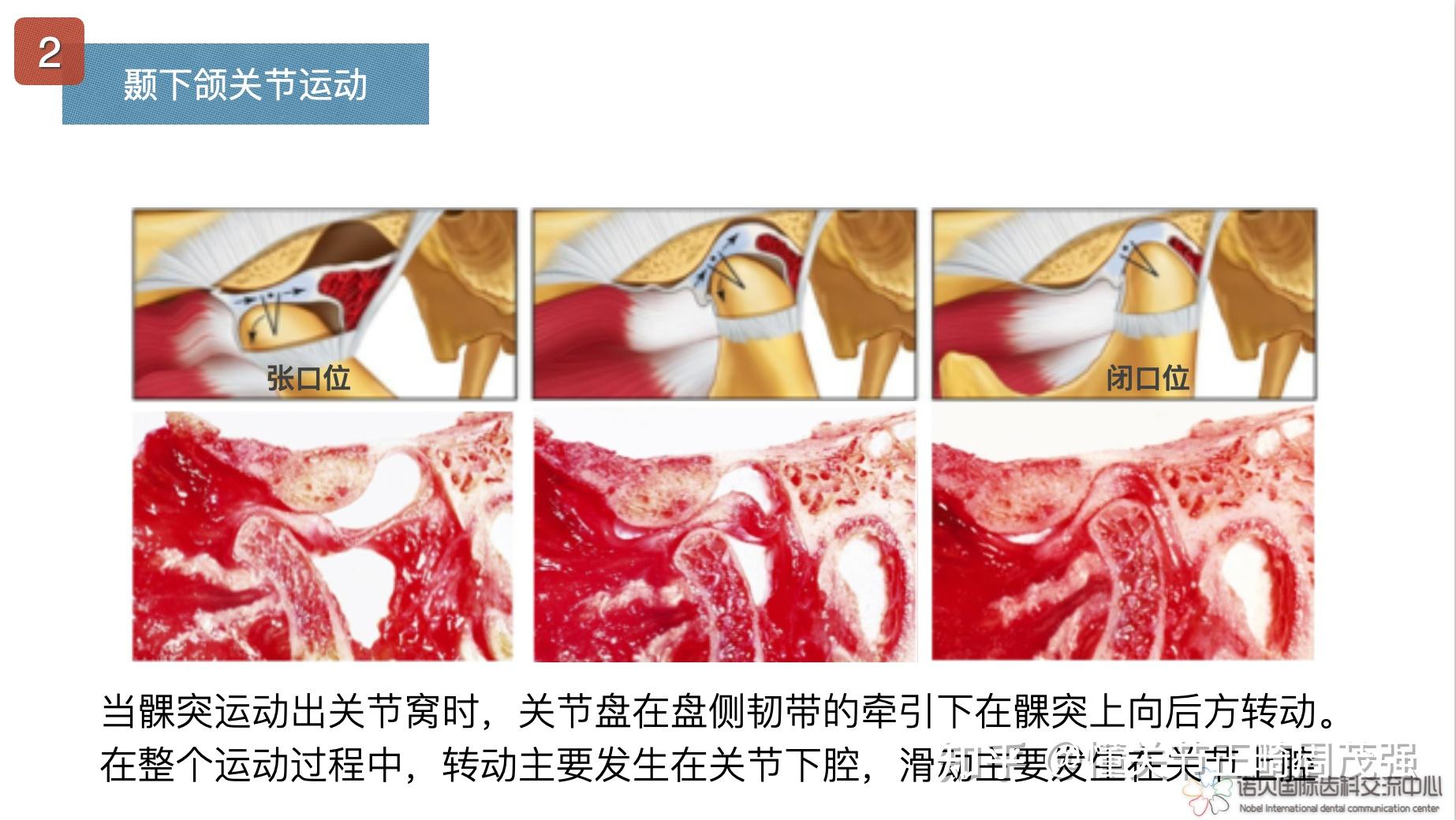 如何看懂颞下颌关节核磁共振影像? - 知乎