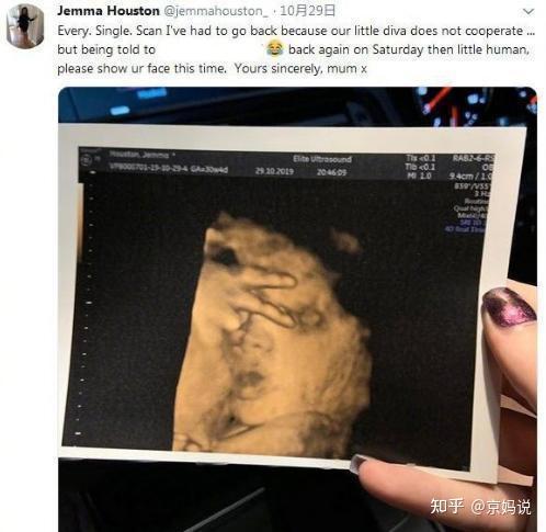 英国的一位孕妈在怀孕38周时去做彩超,在显像下看到了宝宝的可爱样子