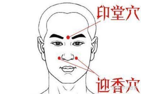 鼻炎能治好吗?怎么治好的? - 知乎