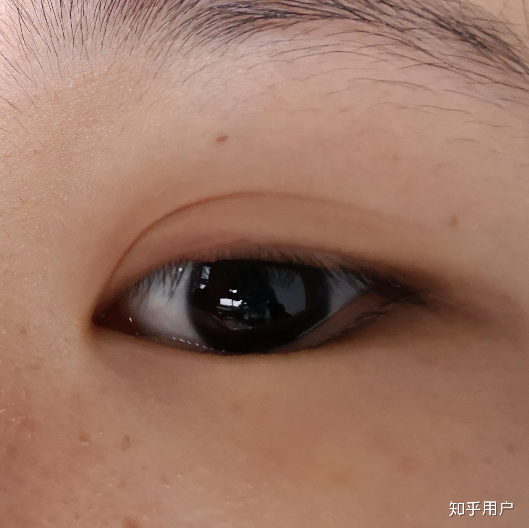 中国人瞳孔稀少颜色图片