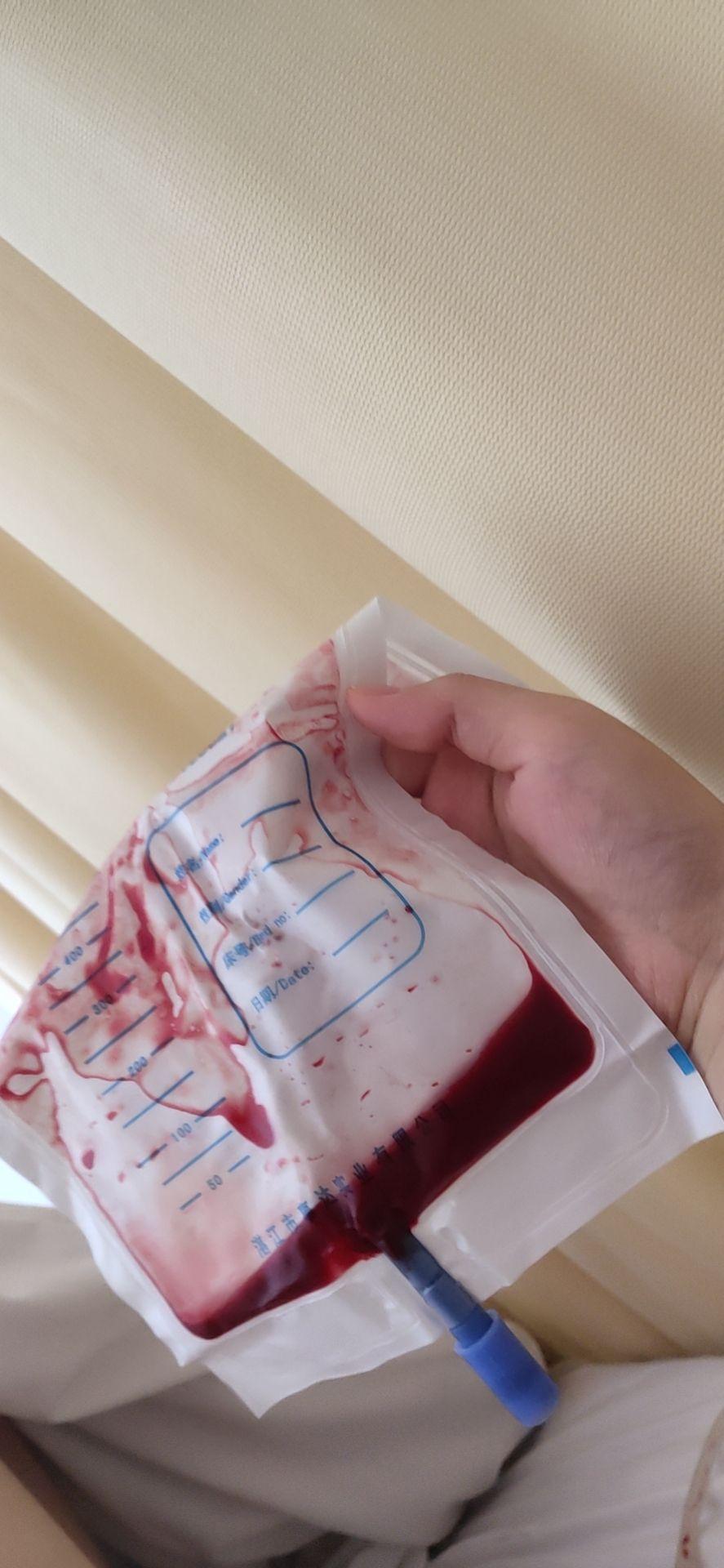 子宫肌瘤腹腔镜手术