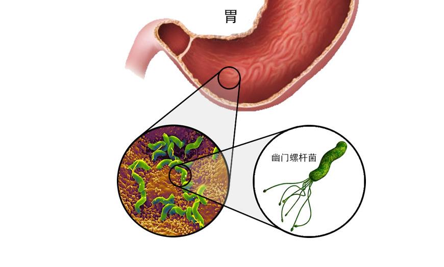 兰索拉唑口服液图片