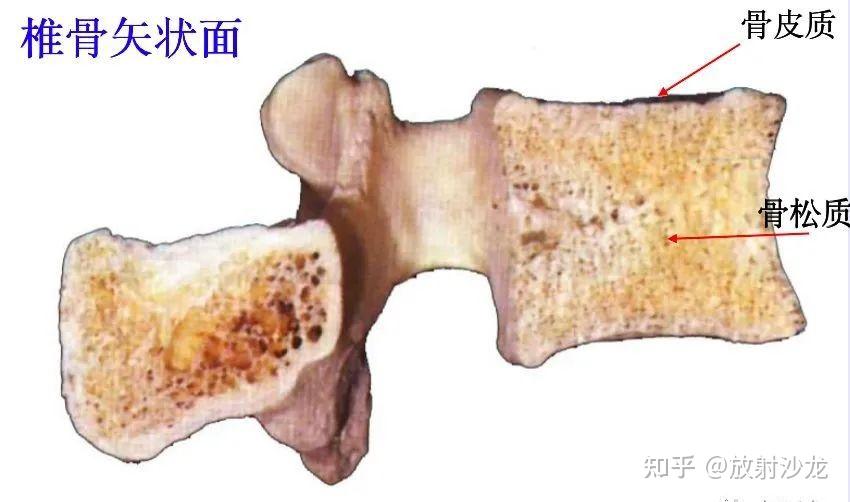松质骨:哈佛氏系统提供骨的强度,良好的固定点坚硬,主要位于骨的表面a