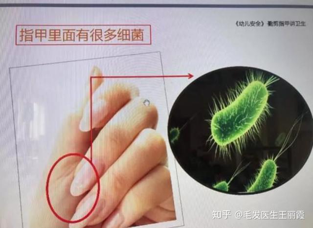 正常的洗头顺序是先用清水冲洗头发,把大部分附着的灰尘细菌等冲掉,再