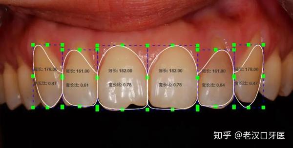 通过分析发现: