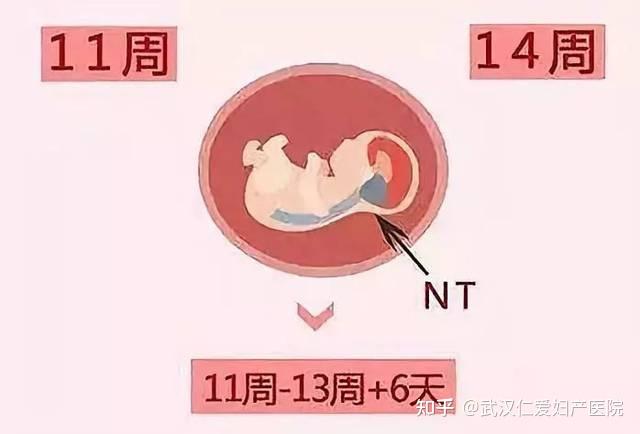孕早期进行的唐筛检查的时间为11-14周,最佳时间为11-13周 6.