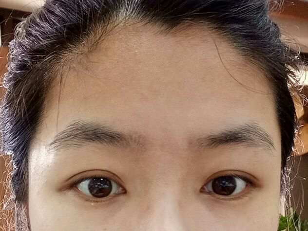 有没有因为额头低而脱发际线的? - 知乎