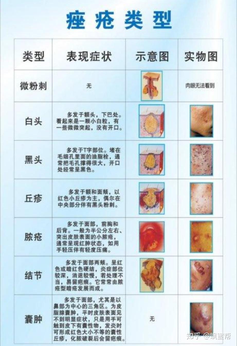 完全停掉护肤品真的对皮肤好吗