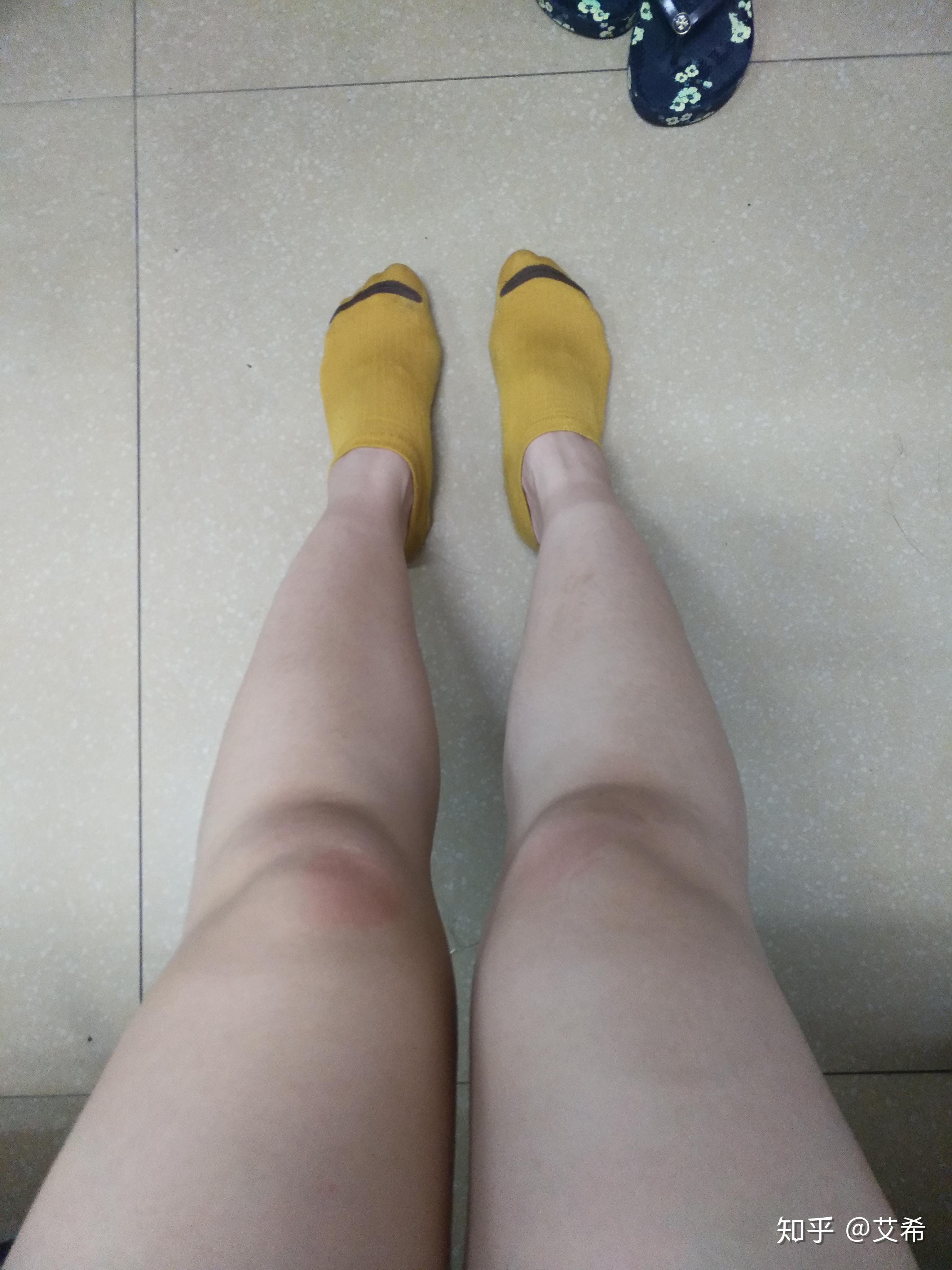 身高164 体重53 小腿35厘米 大腿49厘米,这样腿算粗吗?减肥减肥.