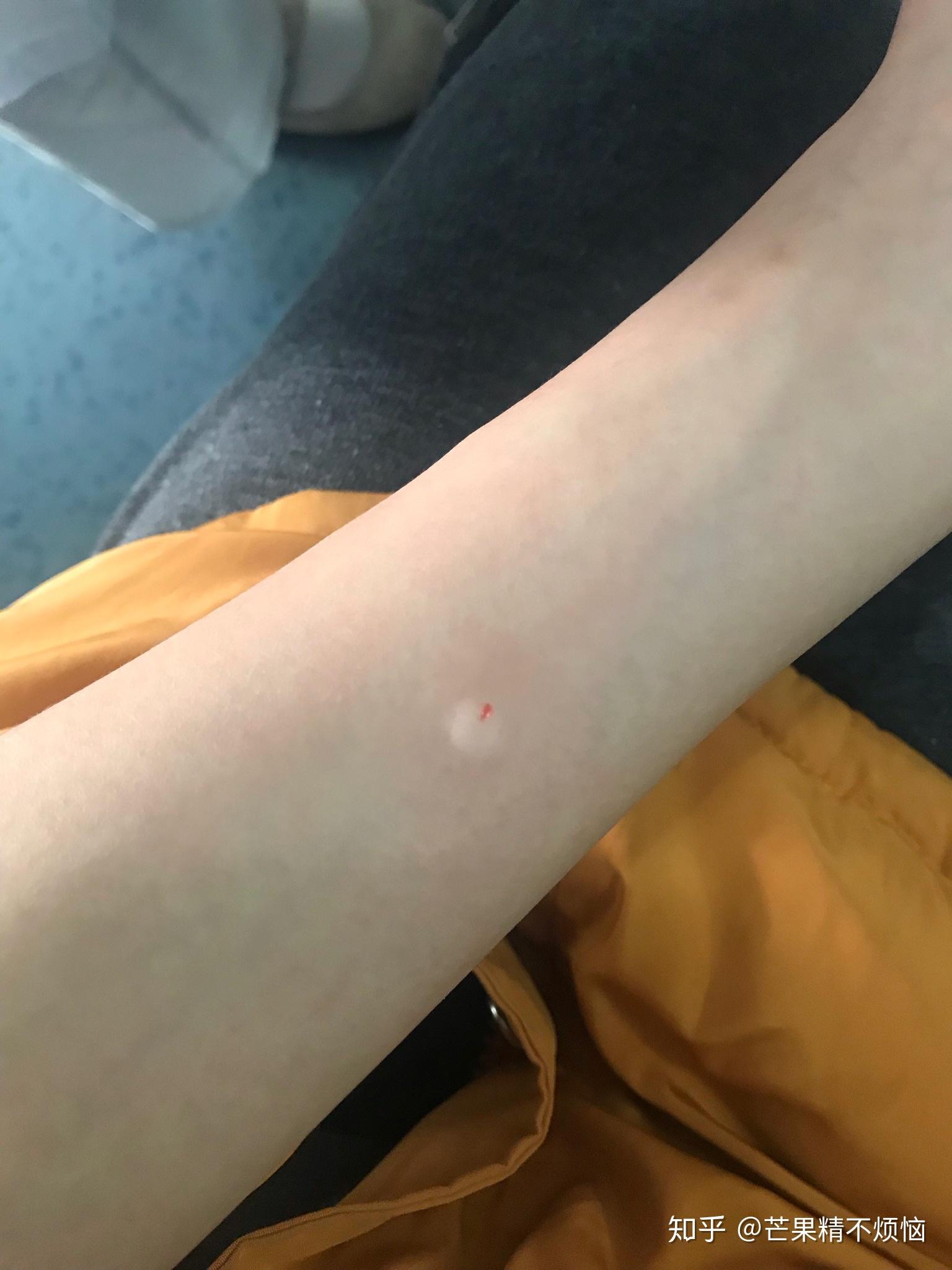 得鼻窦炎是什么体验