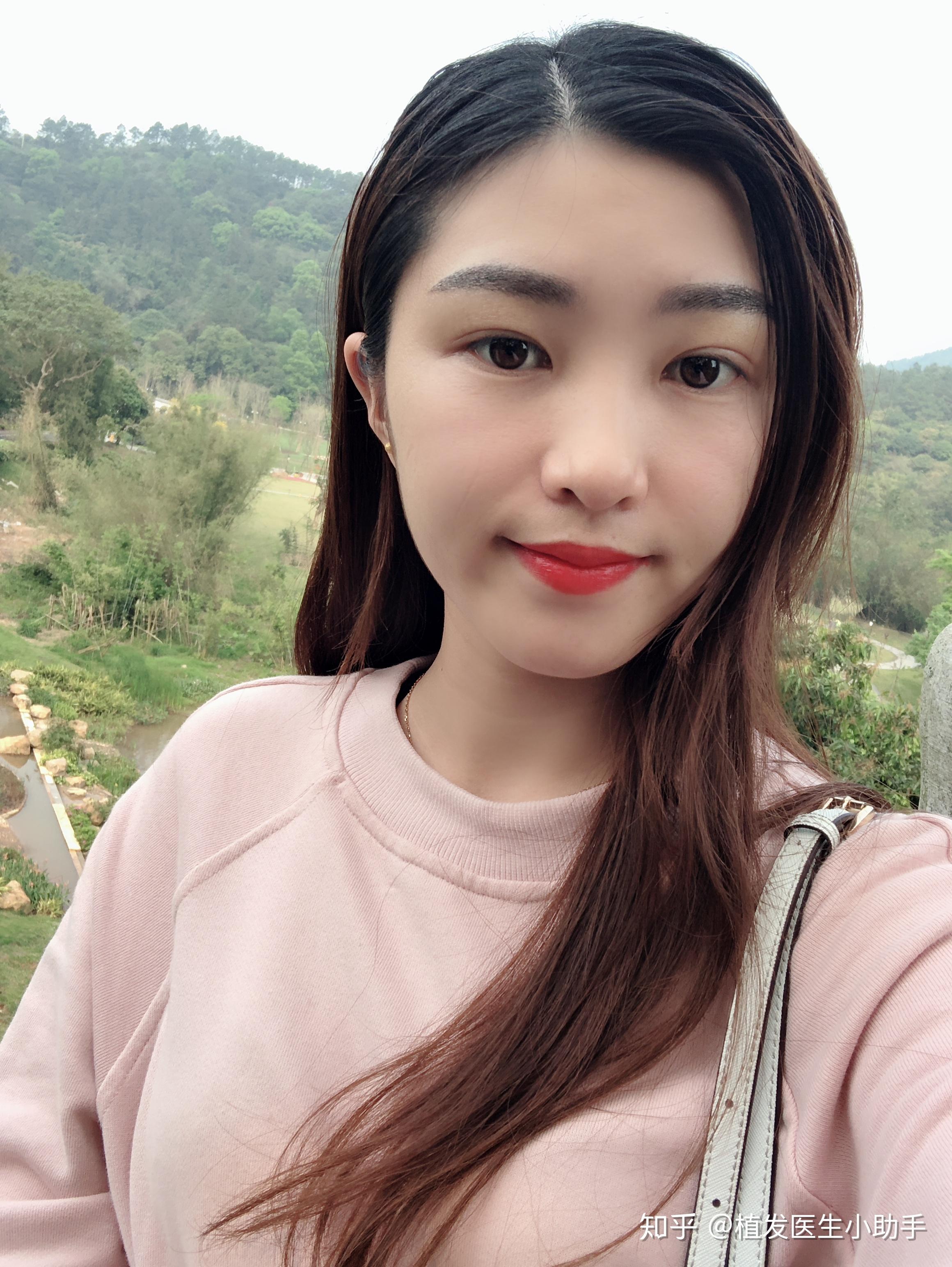 23岁女生狂脱发,怎么能快速生发?