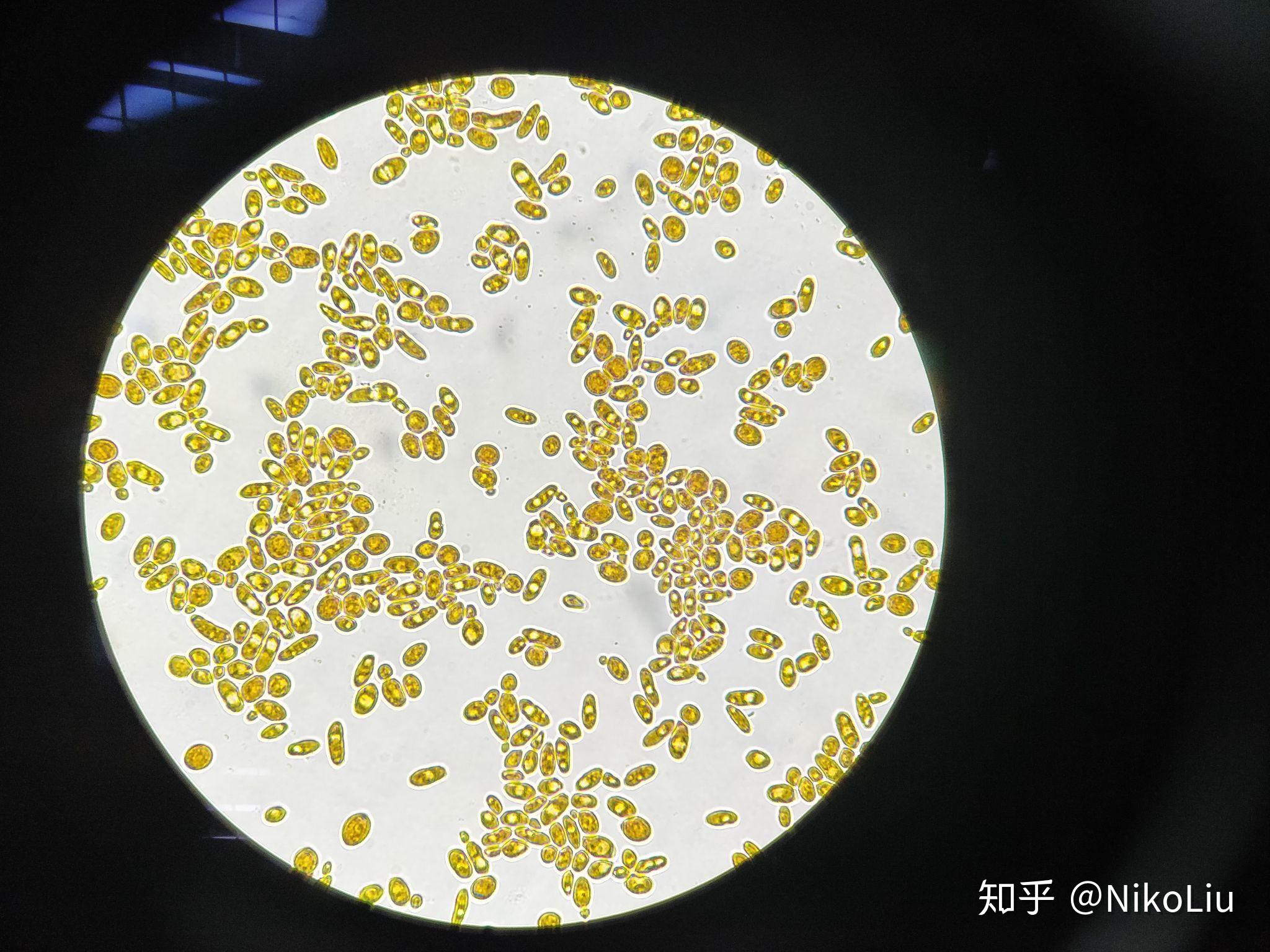 在显微镜下漂浮的大肠杆菌细胞或微生物_3840X2160_高清视频素材下载(编号:6216920)_实拍视频_光厂(VJ师网) www ...