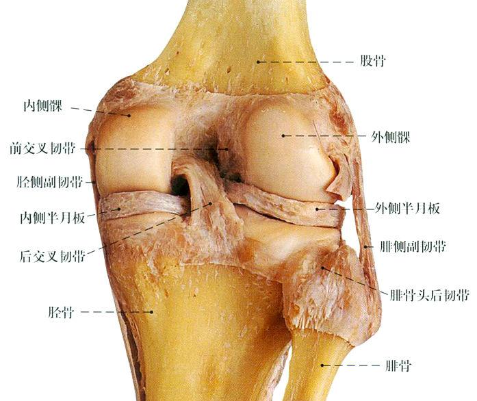 膝關節彈響半月板拉傷韌帶拉傷有積液