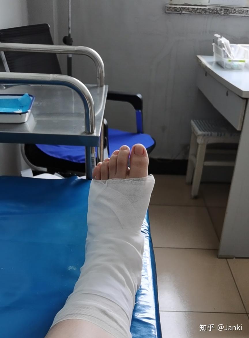 第五趾跖骨骨折多久可以走路