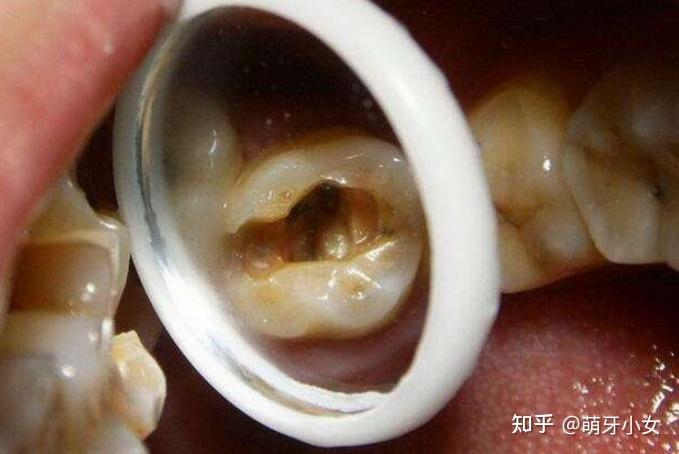 怎么样区分牙痛