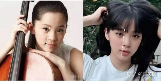 欧阳娜娜终于还是对鼻子下手了