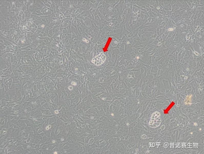 式增殖;营养消耗快,培养基很快变黄,变浑浊;镜下观察有明显的定向运动
