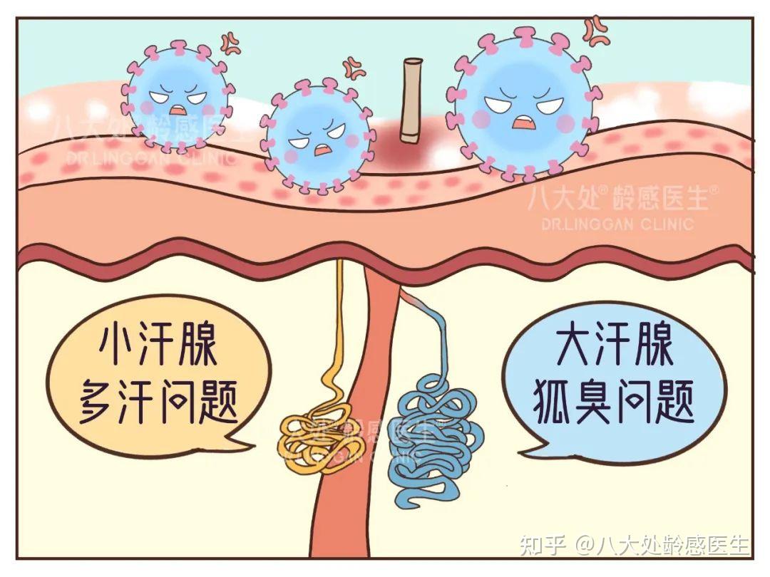狐臭、腋毛多......有啥方法能摆脱腋下尴尬？ - 知乎