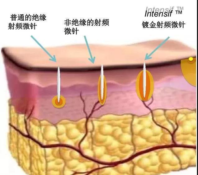 v2-7f3010a409c8957e565ddb68fd0b8a05_1440w.jpg?source=172ae18b
