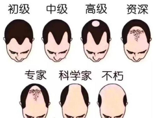 这4种常见的脱发形状你都了解吗? - 知乎