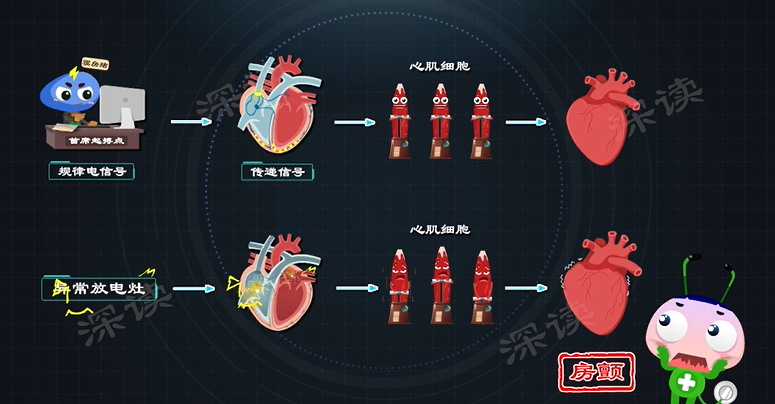 心律失常咋回事心慌胸悶背後真相是啥房顫發病機制動漫版