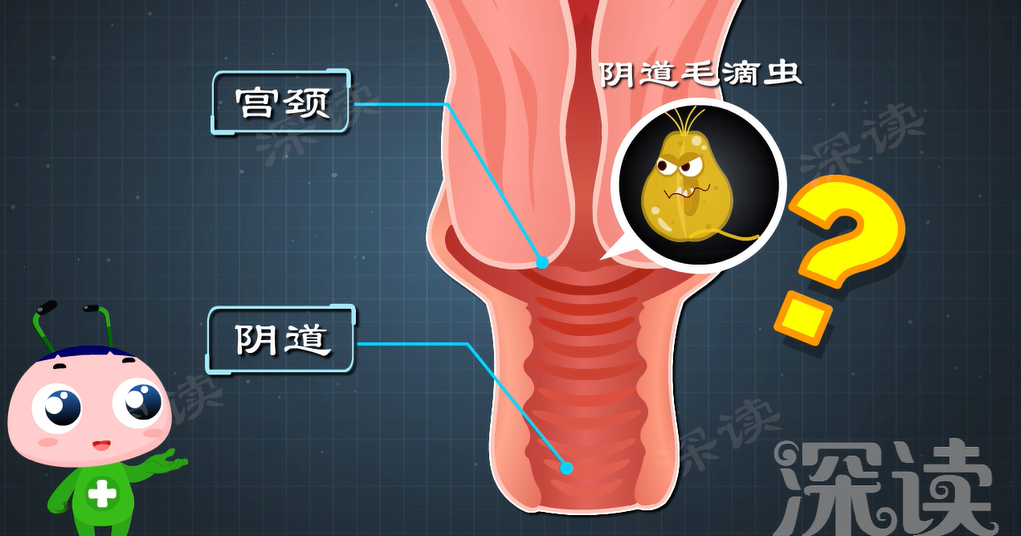 宫颈口部位图片