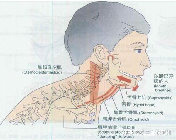 张口疼痛受限、弹响伴随耳鸣？可能是颞下颌关节紊乱 - 知乎