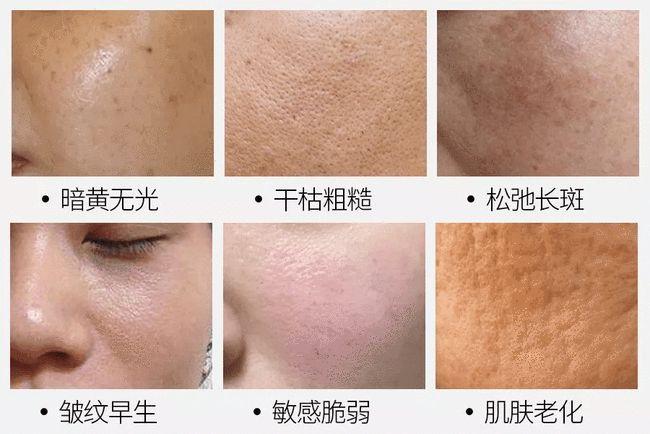 口红色号不敢挑,衣服不敢穿,就连和朋友闺蜜合照,也是分分钟被秒杀~再