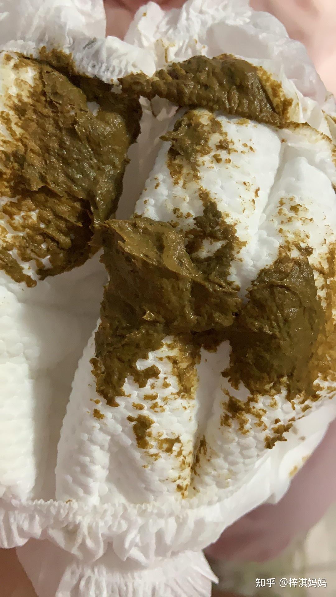 过敏宝宝腹泻粘液便的经历