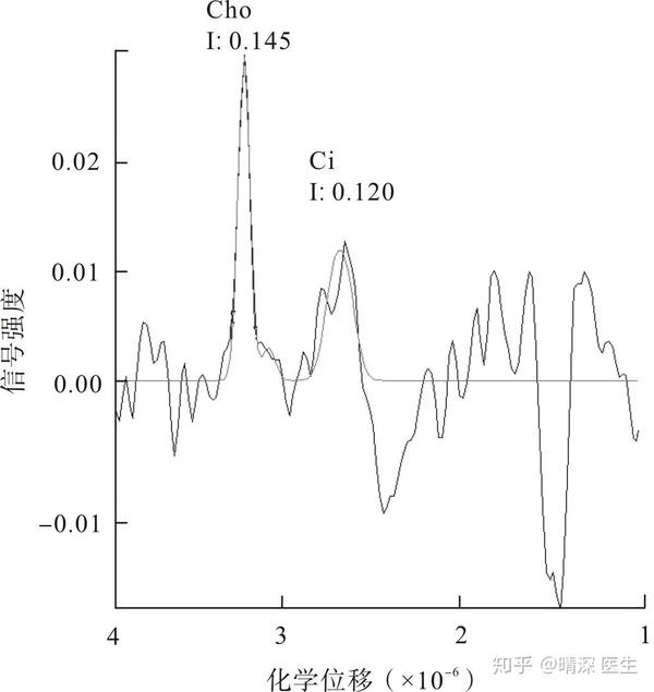 Mri Mrs Mra是什么检查 医学mrs是什么检查 桃丽网