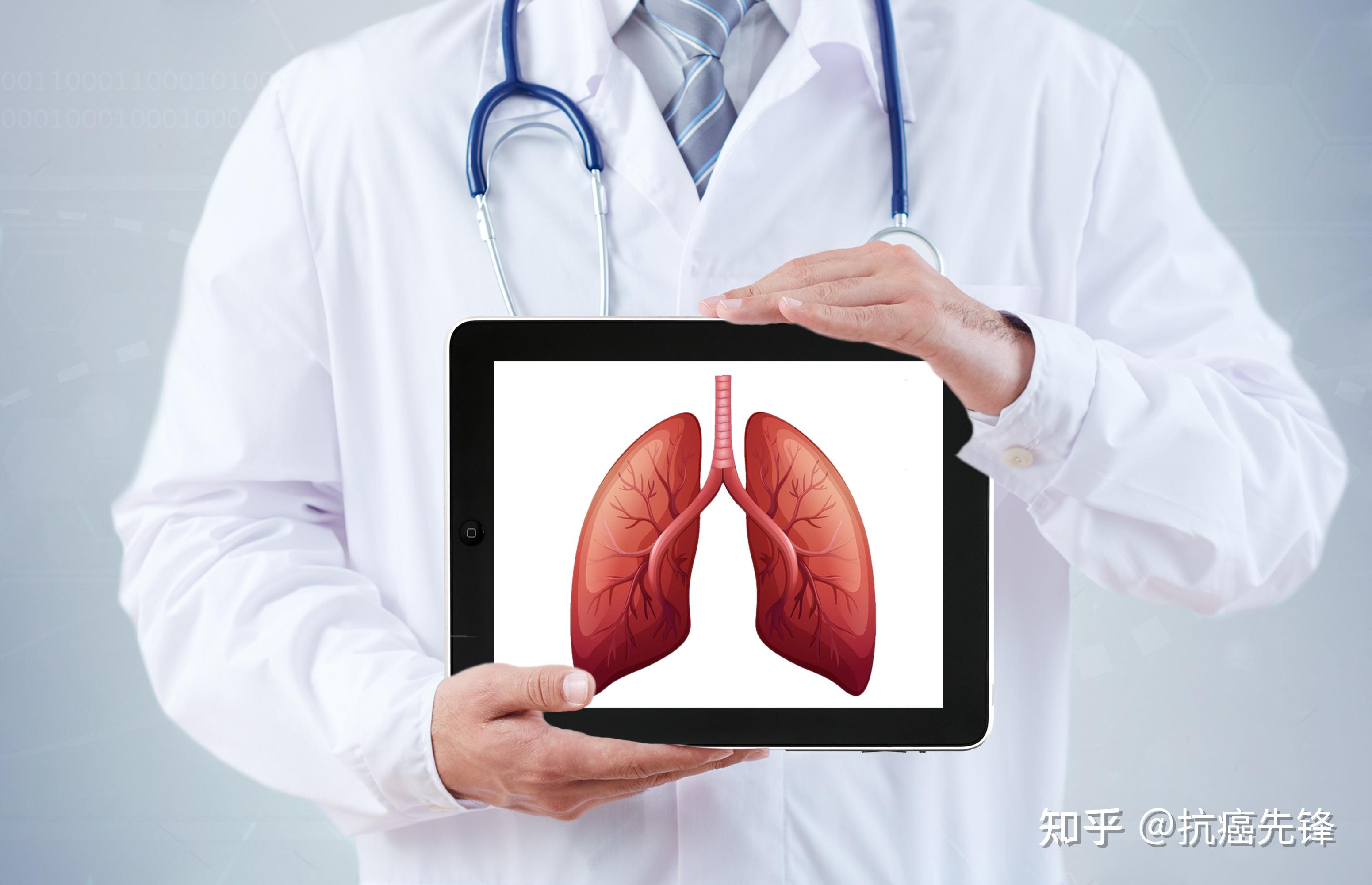 肺癌的ct影像学表现,肺的t图片,肺t图片影像学_大山谷图库