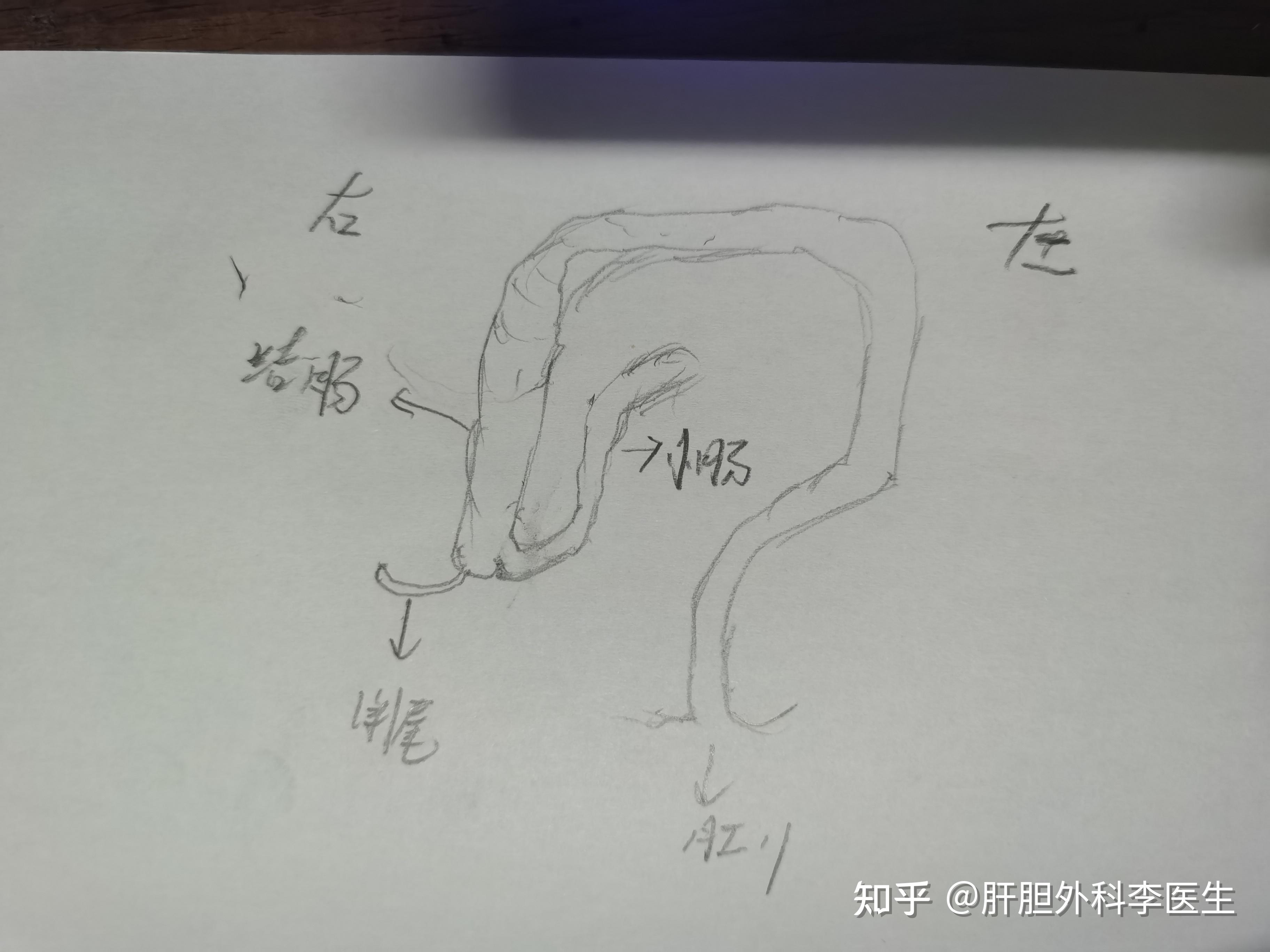 阑尾图片简笔画图片