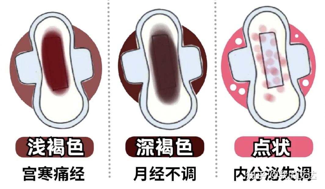 月经颜色竟然与女性健康状况密切相关! - 知乎