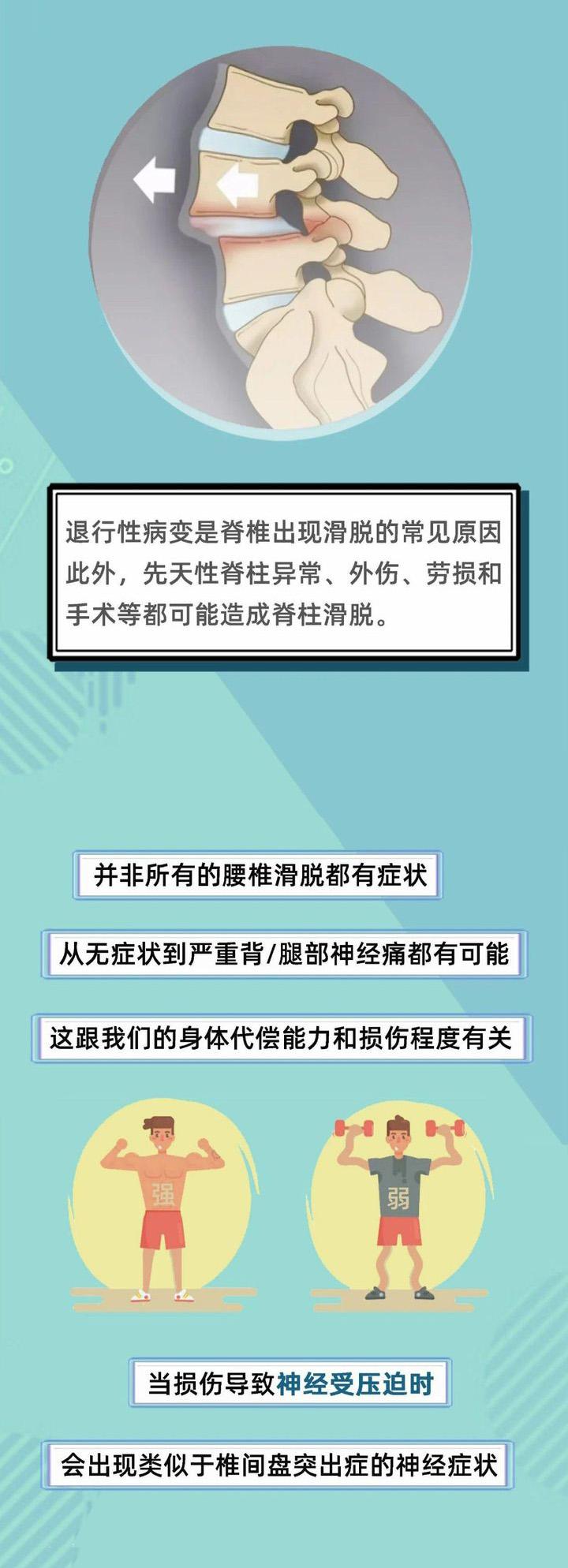 腰椎滑脱有哪些靠谱的治疗方案?