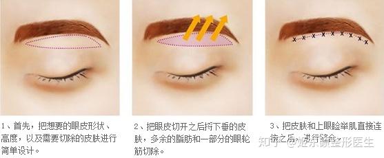 切眉和提眉的区别