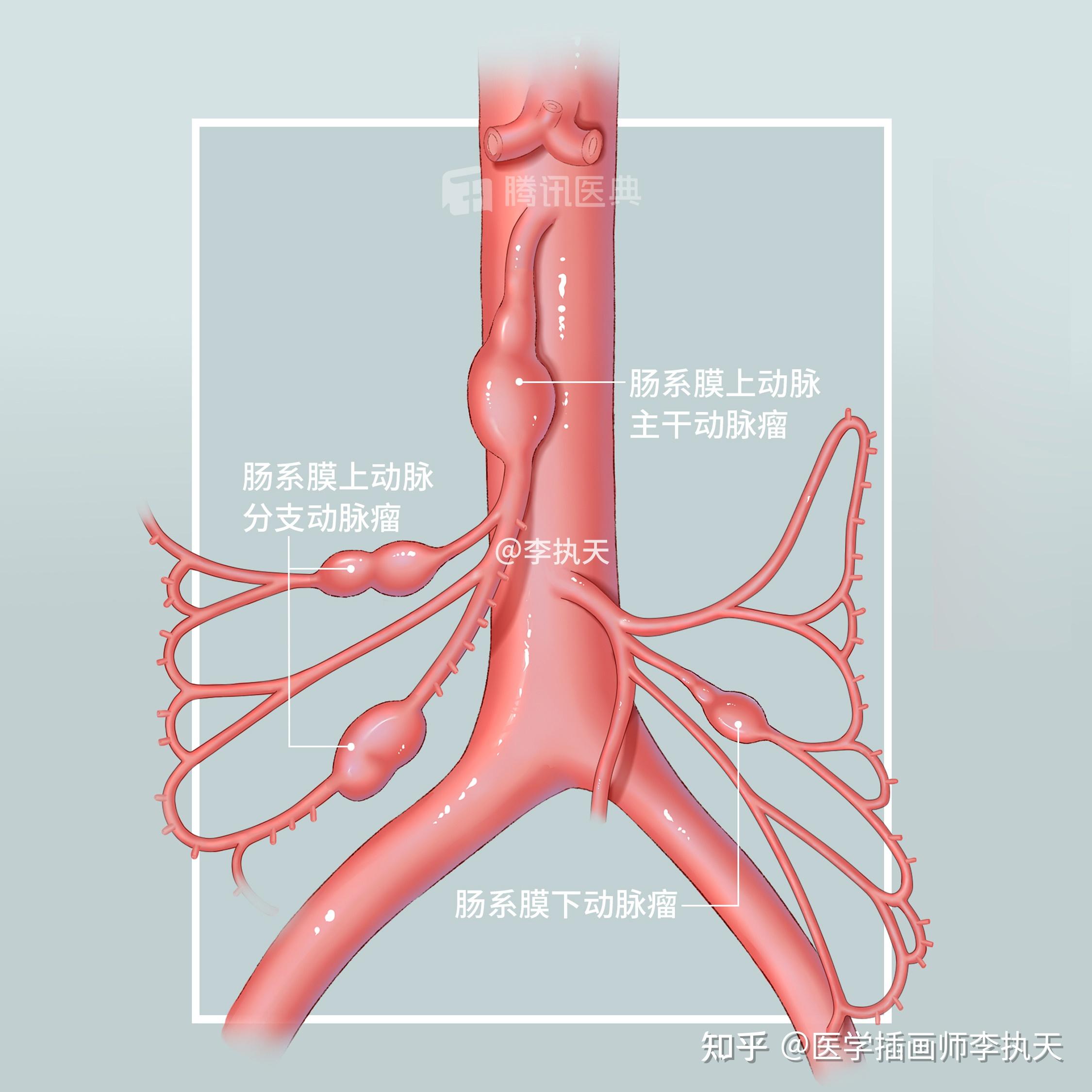 中国有专门的医学插画师吗? - 知乎