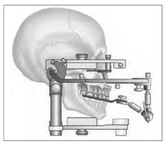 一个口腔修复学博士级的问题髁导斜度切道斜度切导斜度