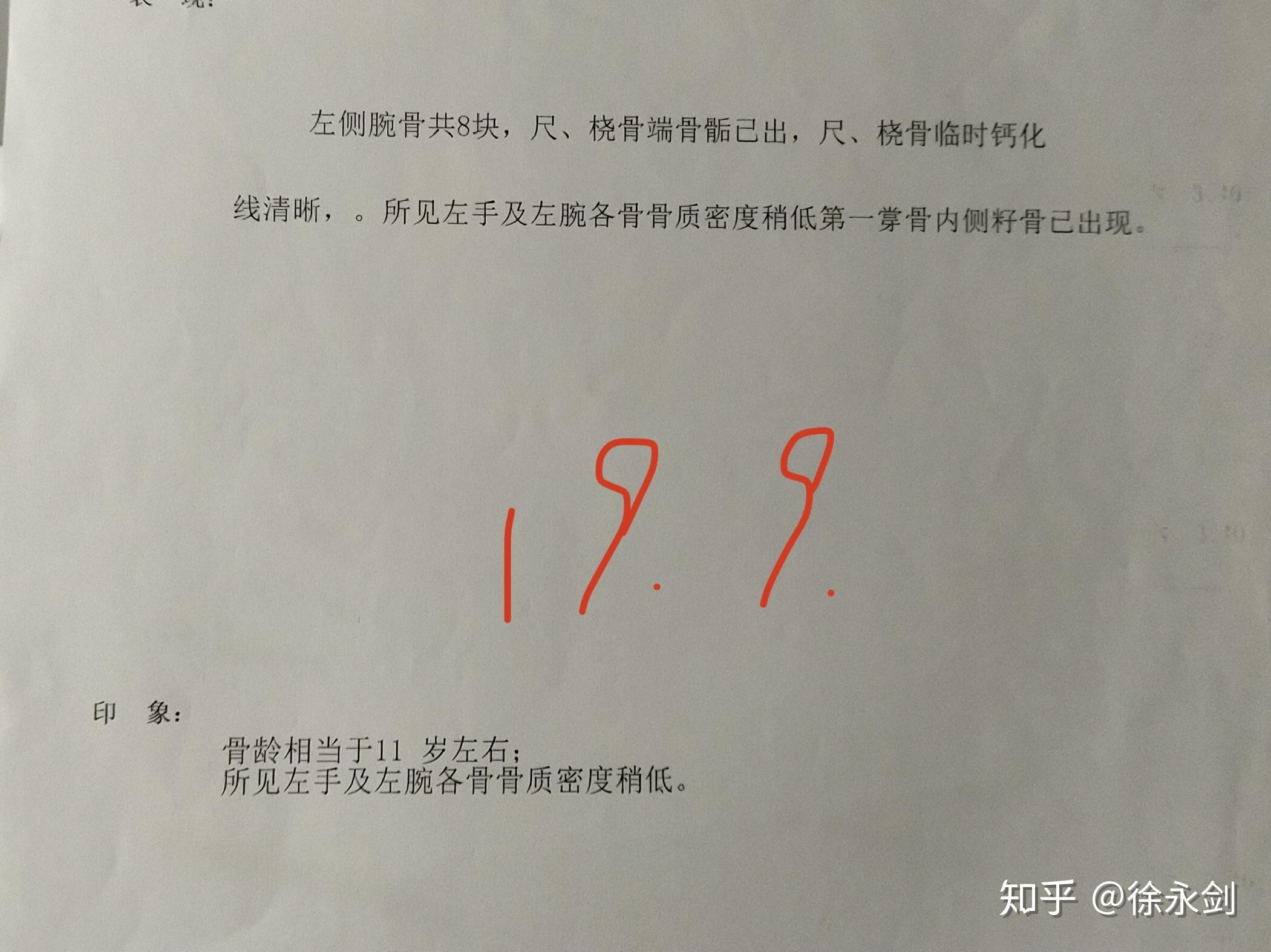 總結:一是骨齡鑑定數據建議用中華05標準鑑定相對來說可靠準確,對於