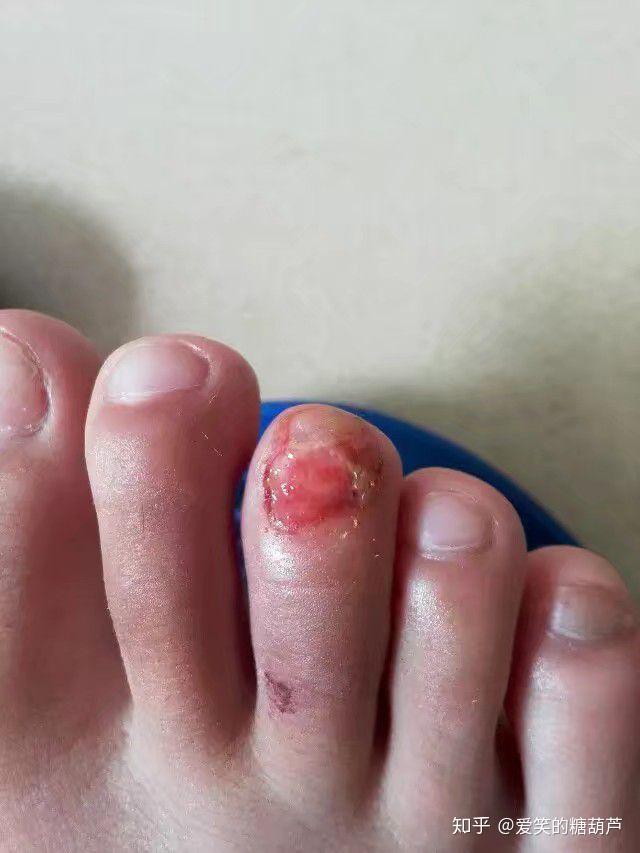 有哪些看着就很疼的照片视频