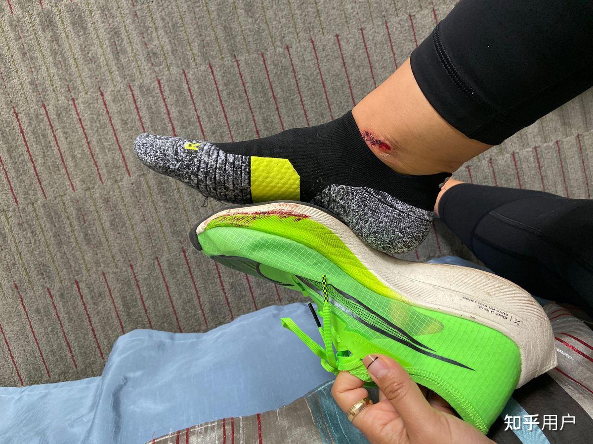 鞋子的脚踝内侧很容易磨损是什么原因,如何改善?