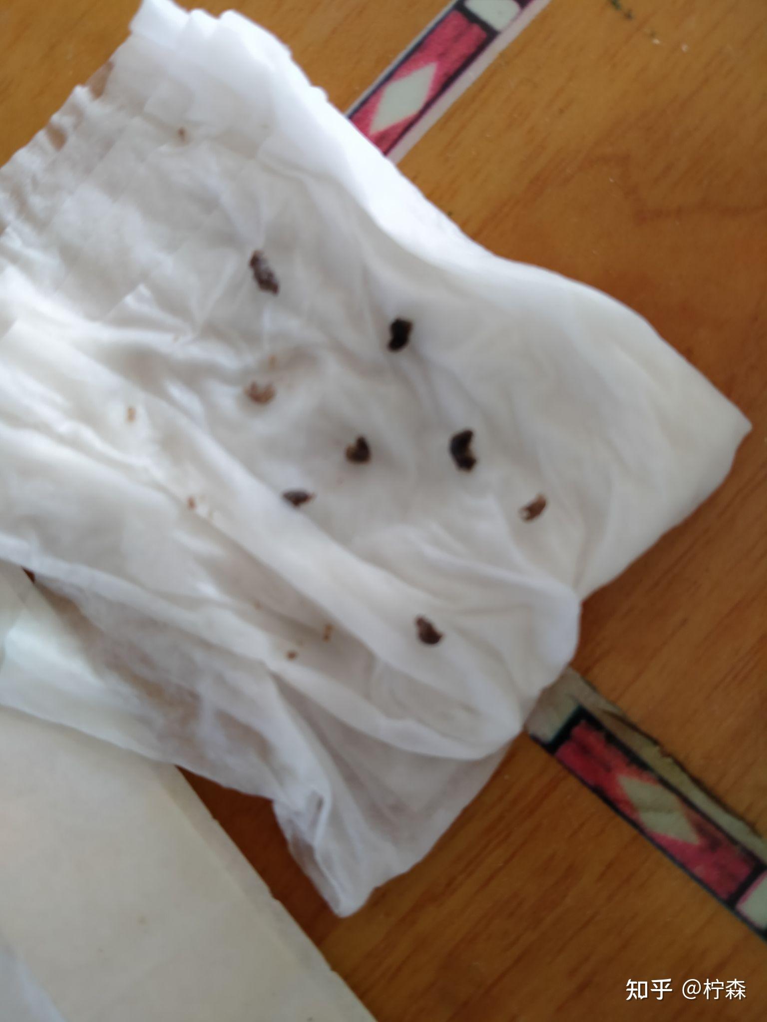 从自己身上扣下来最大的黑头有多大?