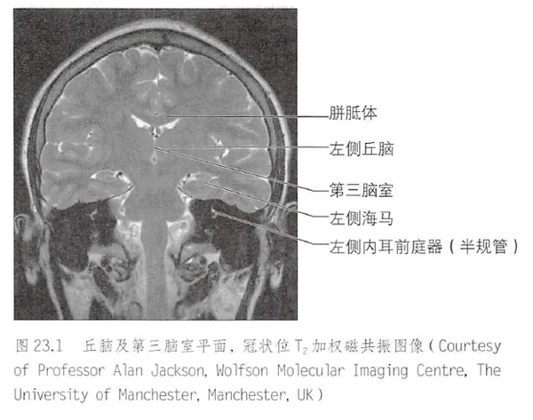 丘脑多图详解 - 知乎