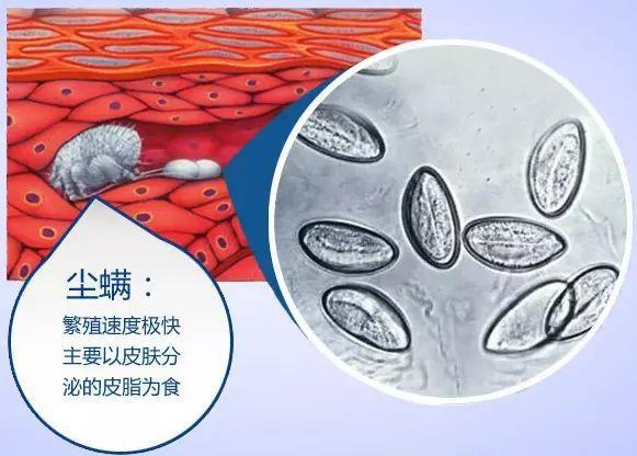 红通通的大鼻子长在你的身上,你该怎么办? - 知乎