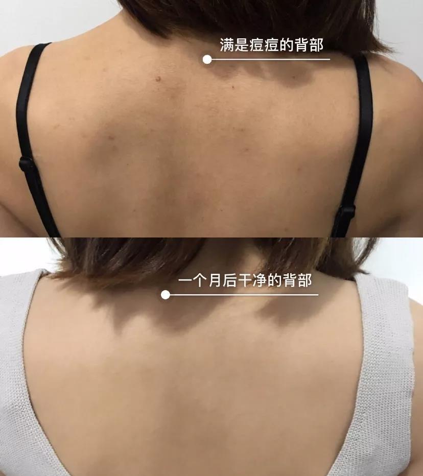 为夏天而生的祛痘沐浴露气哭香水还美白